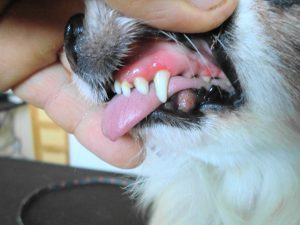 Zahnsteinentfernung nachher